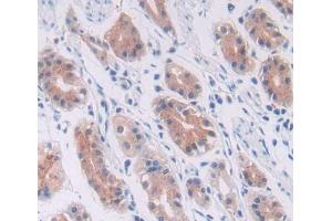 Used in DAB staining on fromalin fixed paraffin- embedded stomach tissue (Cullin 1 antibody  (AA 1-250))