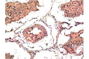 Immunohistochemical analysis of paraffin-embedded Rat Testis Tissue using Bax Mouse mAb diluted at 1:200.