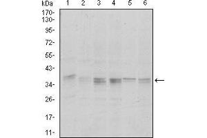 Western blot analysis using PPP1CA mouse mAb against Hela (1), HepG2 (2), MCF-7 (3), Jurkat (4) and A549 (5) cell lysate. (PPP1CA antibody)