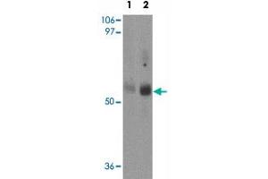 Western blot analysis of MFSD2 in rat lung tissue lysate with MFSD2 polyclonal antibody  at (1) 1 and (2) 2 ug/mL.