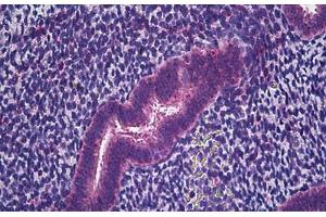 Human Uterus, Endometrium: Formalin-Fixed, Paraffin-Embedded (FFPE) (IFITM1 antibody  (Internal Region))