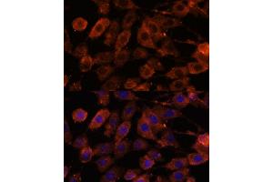 ODZ1/Teneurin 1 antibody  (AA 350-540)