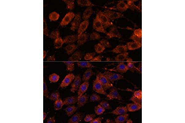 ODZ1/Teneurin 1 antibody  (AA 350-540)