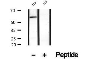 Western blot analysis of extracts of human kidney tissue, using SACM1L antibody. (SACM1L antibody  (Internal Region))