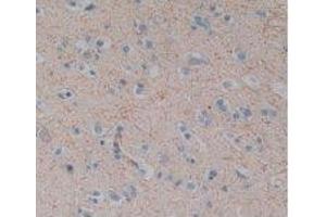 IHC-P analysis of Human Brain Tissue, with DAB staining. (Substance P antibody)
