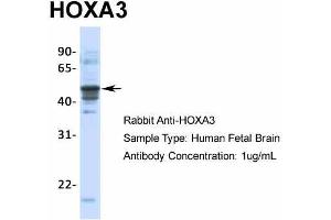 Host:  Rabbit  Target Name:  HOXA3  Sample Type:  Human Fetal Brain  Antibody Dilution:  1. (HOXA3 antibody  (C-Term))