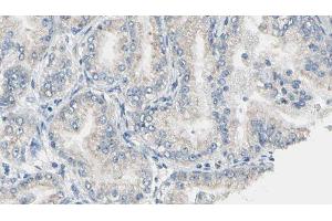 ABIN6276888 at 1/100 staining Human prostate tissue by IHC-P. (ALDH1A1 antibody  (C-Term))