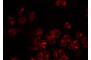 ABIN6274721 staining Hela by IF/ICC. (MRPS35 antibody  (N-Term))