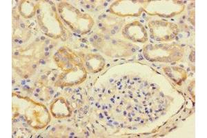 Immunohistochemistry of paraffin-embedded human kidney tissue using ABIN7174731 at dilution of 1:100 (PARP11 antibody  (AA 1-245))