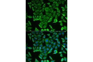 Immunofluorescence (IF) image for anti-Arginyl-tRNA Synthetase (RARS) antibody (ABIN1980323) (RARS antibody)
