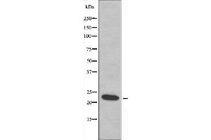 Western blot analysis of extracts from Jurkat cells, using ASF1A antibody. (ASF1A antibody  (Internal Region))