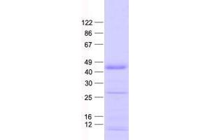 ZNF684 Protein (His tag)