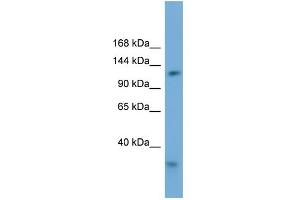 WB Suggested Anti-RFC1 Antibody Titration: 0. (RFC1 antibody  (Middle Region))