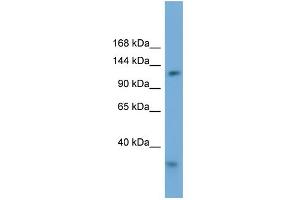 Western Blotting (WB) image for anti-Replication Factor C (Activator 1) 1, 145kDa (RFC1) (Middle Region) antibody (ABIN2786753)