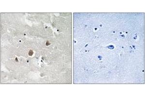 Immunohistochemistry analysis of paraffin-embedded human brain, using MAP3K1 (Phospho-Thr1402) Antibody. (MAP3K1 antibody  (pThr1402))