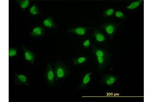 Immunofluorescence of monoclonal antibody to CRSP6 on HeLa cell. (MED17 antibody  (AA 551-651))