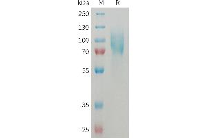 Intercellular Adhesion Molecule 1 (ICAM1) (AA 28-485) protein (His tag)