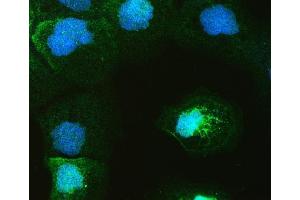 IF analysis of GAL4 using anti-GAL4 antibody (ABIN4886660). (GAL4 antibody  (C-Term))