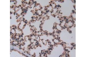 Immunohistochemistry (Paraffin-embedded Sections) (IHC (p)) image for anti-beta-Thromboglobulin (beta-TG) (AA 40-113) antibody (ABIN2909757)