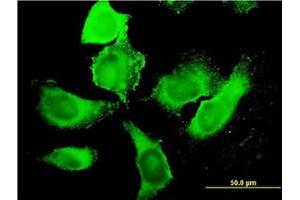 Image no. 3 for anti-phosphoinositide Kinase, FYVE Finger Containing (PIKFYVE) (AA 342-452) antibody (ABIN599337) (PIKFYVE antibody  (AA 342-452))