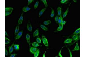 Immunofluorescent analysis of Hela cells using ABIN7153080 at dilution of 1:100 and Alexa Fluor 488-congugated AffiniPure Goat Anti-Rabbit IgG(H+L) (FOXO1 antibody  (AA 1-300))