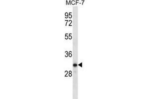 TESSP1 Antibody (Center) western blot analysis in MCF-7 cell line lysates (35 µg/lane). (TESSP1 antibody  (Middle Region))