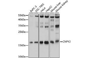 Western blot analysis of extracts of various cell lines, using CNPY2 antibody. (CNPY2/MSAP antibody)