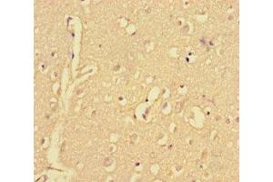 Immunohistochemistry of paraffin-embedded human brain tissue using ABIN7148515 at dilution of 1:100 (Copine II antibody  (AA 1-300))