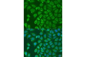 Immunofluorescence analysis of U2OS cells using HOXD10 antibody (ABIN2736912) at dilution of 1:100. (HOXD10 antibody)
