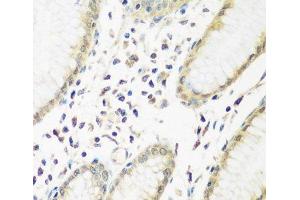 PYCR1 antibody