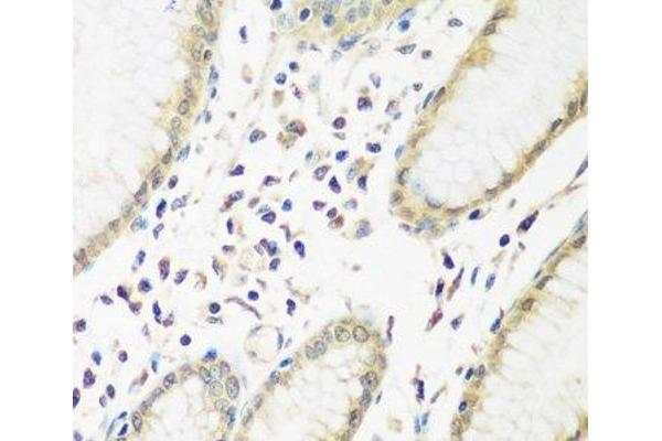 PYCR1 antibody