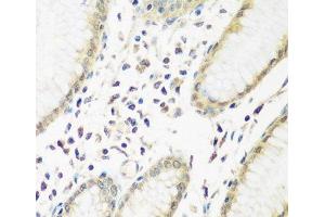 Immunohistochemistry of paraffin-embedded Human stomach using PYCR1 Polyclonal Antibody at dilution of 1:200 (40x lens).