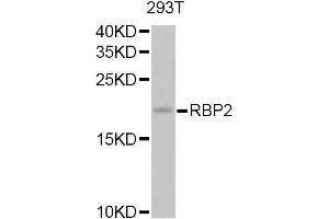 Western blot analysis of extracts of 293T cells, using RBP2 Antibody.