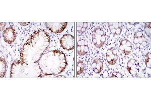 Immunohistochemical analysis of paraffin-embedded stomach tissues (left) and colon tissues (right) using CA9 mouse mAb with DAB staining. (CA9 antibody)
