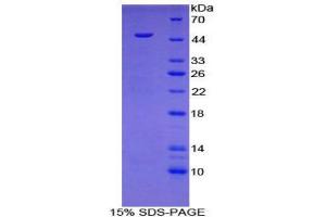 SDS-PAGE (SDS) image for Hyaluronidase-1 (HYAL1) (AA 52-462) protein (His tag) (ABIN2121269) (HYAL1 Protein (AA 52-462) (His tag))
