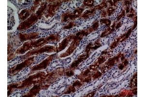 Immunohistochemistry (IHC) analysis of paraffin-embedded Human Kidney, antibody was diluted at 1:100. (GGT1 antibody  (N-Term))