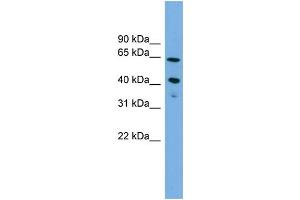 WB Suggested Anti-ATP8B2  Antibody Titration: 0. (ATP8B2 antibody  (N-Term))