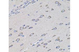Immunohistochemistry of paraffin-embedded Rat brain using TMC1 Polyclonal Antibody at dilution of 1:100 (40x lens). (TMC1 antibody)