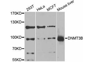 Western blot analysis of extracts of various cell lines, using DNMT3B antibody (ABIN5997608) at 1/1000 dilution. (DNMT3B antibody)