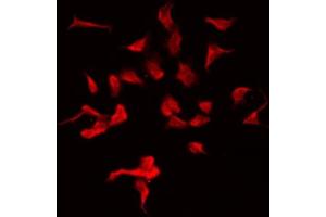 ABIN6275426 staining HeLa by IF/ICC. (MOV10L1 antibody  (Internal Region))