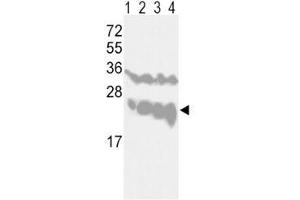 Western blot analysis of PGP9. (UCHL1 antibody  (AA 16-46))