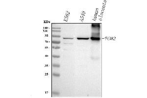 Western blot analysis of TGM2 using anti-TGM2 antibody (ABIN7600494).