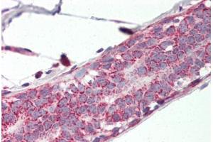 Human Breast (formalin-fixed, paraffin-embedded) stained with PHB2 antibody ABIN337044 at 5 ug/ml followed by biotinylated goat anti-rabbit IgG secondary antibody ABIN481713, alkaline phosphatase-streptavidin and chromogen. (Prohibitin 2 antibody  (AA 88-299))