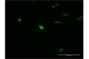 Immunofluorescence of monoclonal antibody to MEOX1 on HeLa cell. (MEOX1 antibody  (AA 82-170))