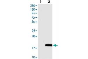 Western blot analysis of Lane 1: Negative control (vector only transfected HEK293T lysate), Lane 2: Over-expression Lysate (Co-expressed with a C-terminal myc-DDK tag (~3. (DSCR4 antibody)
