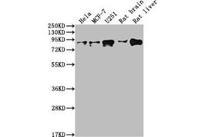 Western Blot Positive WB detected in: Hela whole cell lysate, MCF-7 whole cell lysate, U251 whole cell lysate, Rat brain tissue, Rat liver tissue All lanes: VCP antibody at 1:2000 Secondary Goat polyclonal to rabbit IgG at 1/50000 dilution Predicted band size: 90 kDa Observed band size: 90 kDa (Recombinant VCP antibody)
