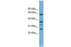 Image no. 1 for anti-Apolipoprotein L, 2 (APOL2) (C-Term) antibody (ABIN6746314) (Apolipoprotein L 2 antibody  (C-Term))