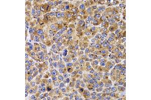 Immunohistochemistry of paraffin-embedded mouse cancer using UBE2R2 antibody. (UBE2R2 antibody  (AA 1-238))
