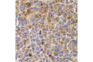 Immunohistochemistry of paraffin-embedded mouse cancer using UBE2R2 antibody. (UBE2R2 antibody  (AA 1-238))