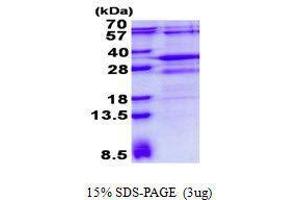 Figure annotation denotes ug of protein loaded and % gel used. (RSG1 Protein)